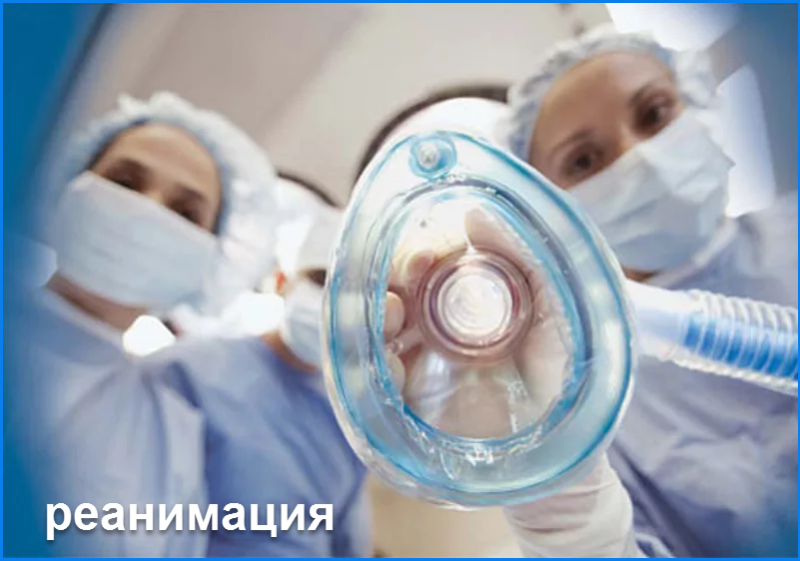 реанимация